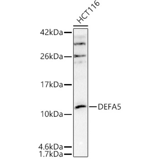 DEFA5 Rabbit Polyclonal Antibody