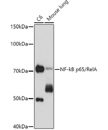 NF-kB p65/RelA Mouse Monoclonal Antibody