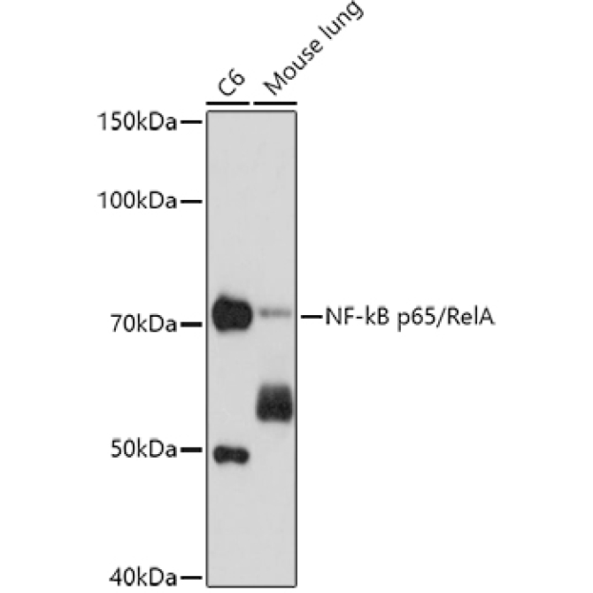 NF-kB p65/RelA Mouse Monoclonal Antibody