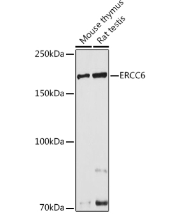 ERCC6 Rabbit Polyclonal Antibody