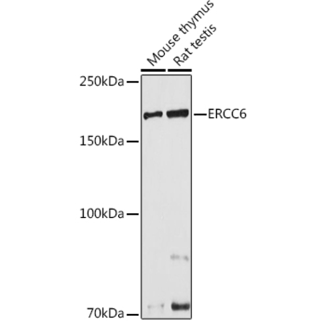 ERCC6 Rabbit Polyclonal Antibody