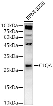 C1QA Rabbit Polyclonal Antibody