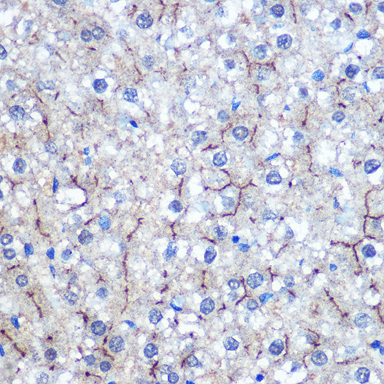 HILPDA Rabbit Polyclonal Antibody