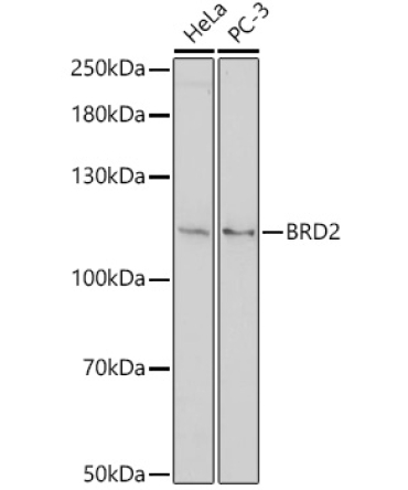 BRD2 Rabbit Polyclonal Antibody