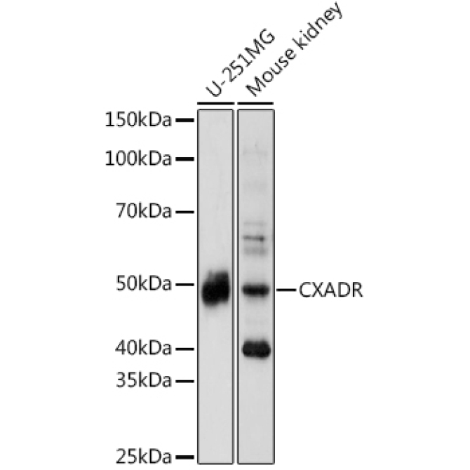 CAR/CXADR Rabbit Polyclonal Antibody