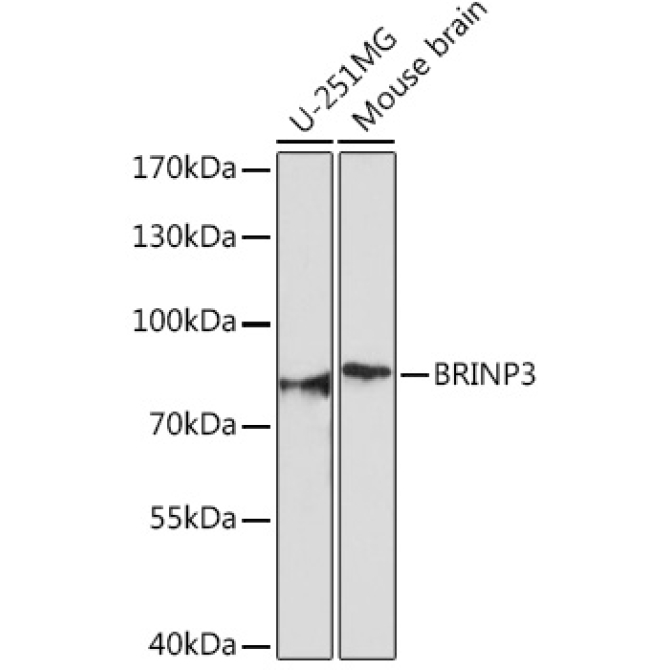 BRINP3 Rabbit Polyclonal Antibody