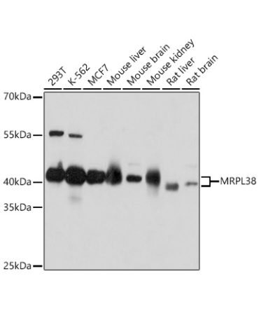 MRPL38 Rabbit Polyclonal Antibody
