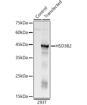 HSD3B2 Rabbit Polyclonal Antibody
