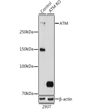 ATM Rabbit Polyclonal Antibody [KO Validated]