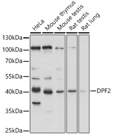 DPF2 Rabbit Polyclonal Antibody