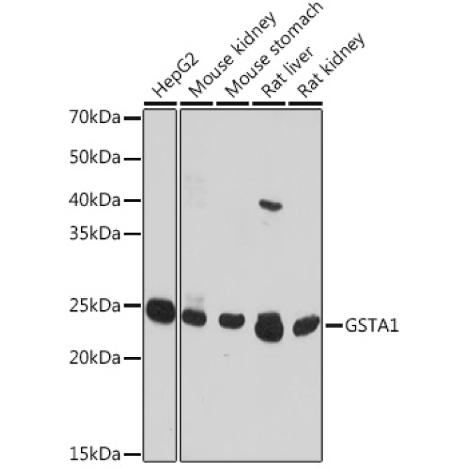 GSTA1 Rabbit Polyclonal Antibody