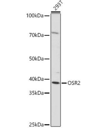 OSR2 Rabbit Polyclonal Antibody