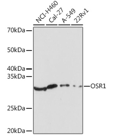 OSR1 Rabbit Polyclonal Antibody