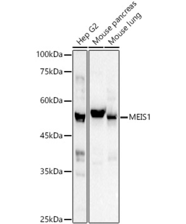 MEIS1 Rabbit Polyclonal Antibody