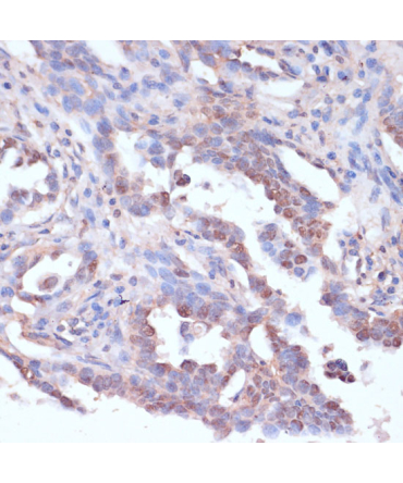 CARTPT Rabbit Polyclonal Antibody