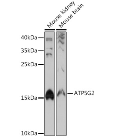 ATP5G2 Rabbit Polyclonal Antibody