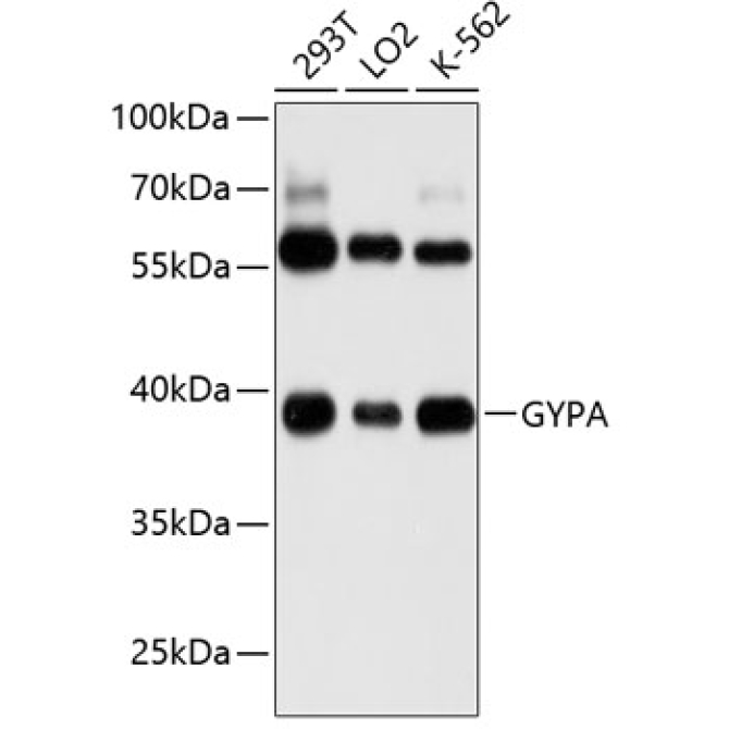 GYPA Rabbit Polyclonal Antibody