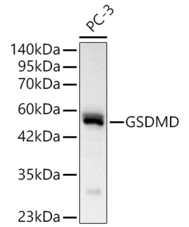 GSDMD (Full length+N terminal) Rabbit Polyclonal Antibody