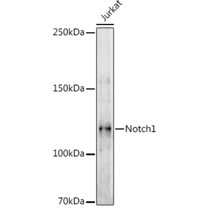 Notch1 Rabbit Polyclonal Antibody