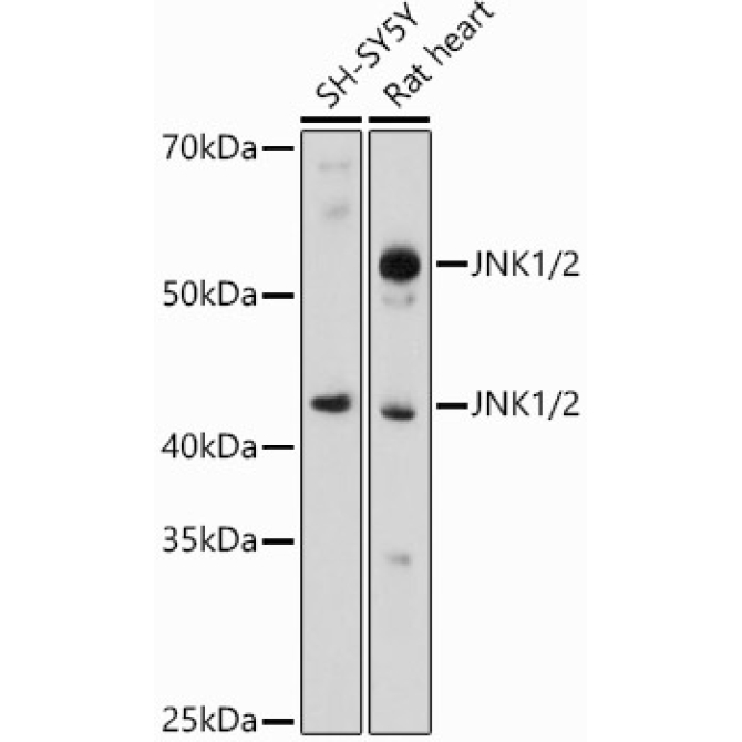 JNK1/2 Rabbit Polyclonal Antibody