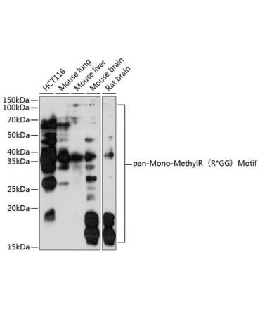 pan-Mono-MethylR?R*GG?Motif Rabbit Polyclonal Antibody
