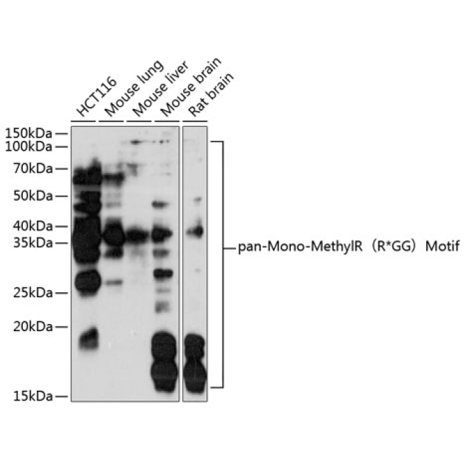 pan-Mono-MethylR?R*GG?Motif Rabbit Polyclonal Antibody