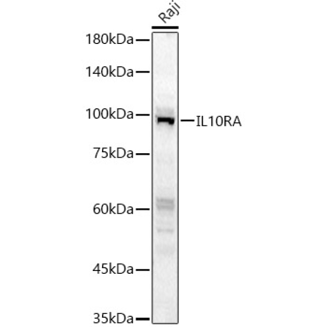 IL10RA Rabbit Polyclonal Antibody