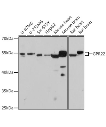 GPR22 Rabbit Polyclonal Antibody