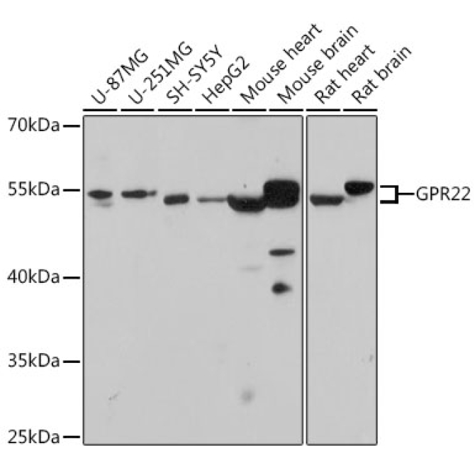 GPR22 Rabbit Polyclonal Antibody