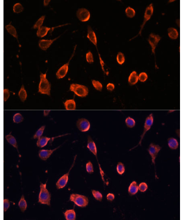 MT-ATP6 Rabbit Polyclonal Antibody