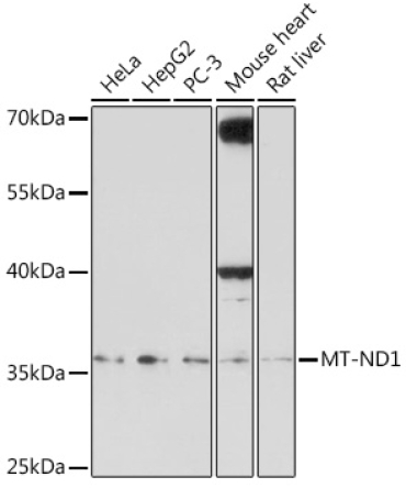 MT-ND1 Rabbit Polyclonal Antibody