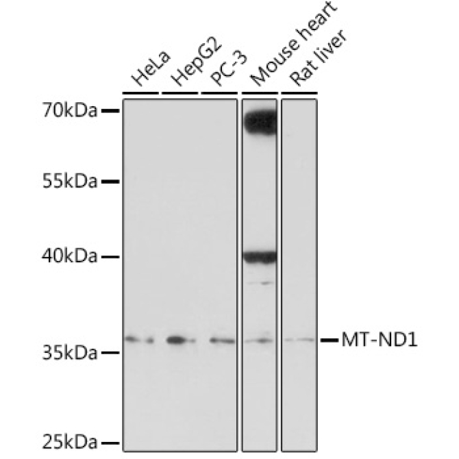 MT-ND1 Rabbit Polyclonal Antibody