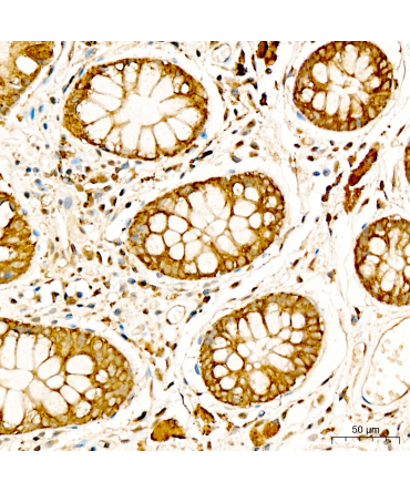 MT-CO3 Rabbit Polyclonal Antibody