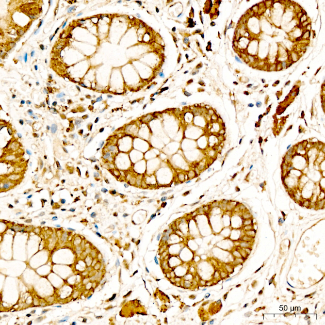 MT-CO3 Rabbit Polyclonal Antibody