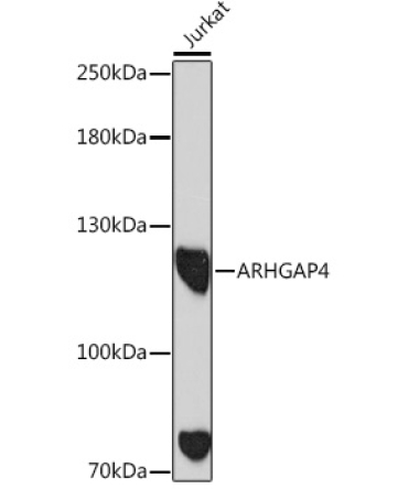 ARHGAP4 Rabbit Polyclonal Antibody