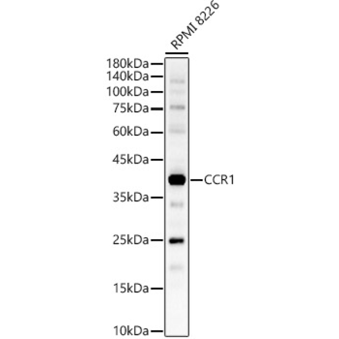 CCR1 Rabbit Polyclonal Antibody