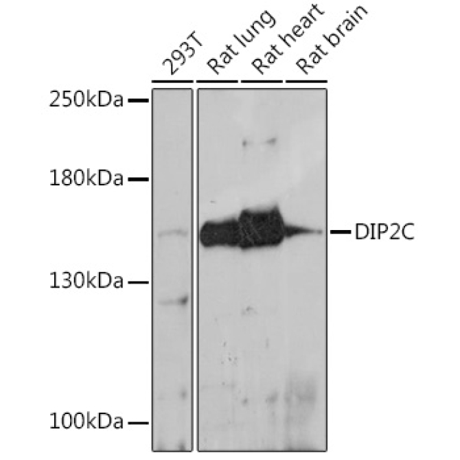 DIP2C Rabbit Polyclonal Antibody