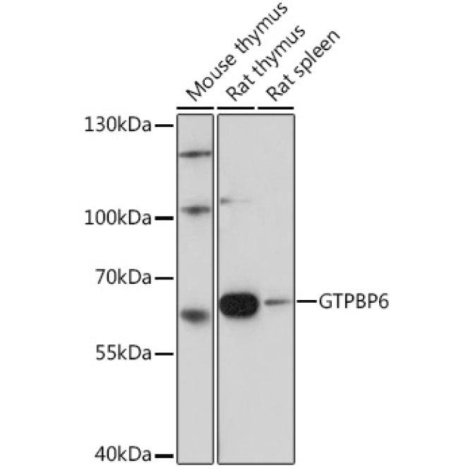 GTPBP6 Rabbit Polyclonal Antibody
