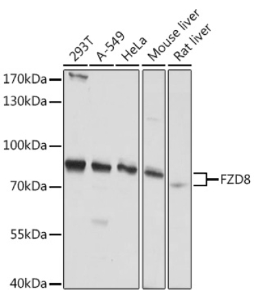 FZD8 Rabbit Polyclonal Antibody