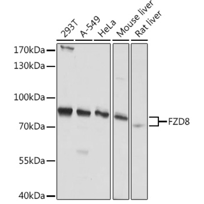 FZD8 Rabbit Polyclonal Antibody