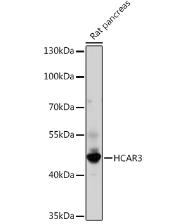 HCAR3 Rabbit Polyclonal Antibody