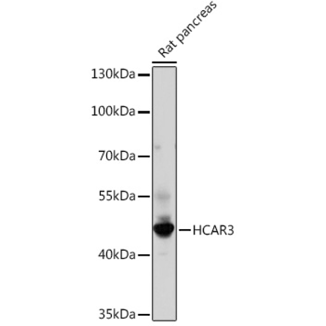 HCAR3 Rabbit Polyclonal Antibody