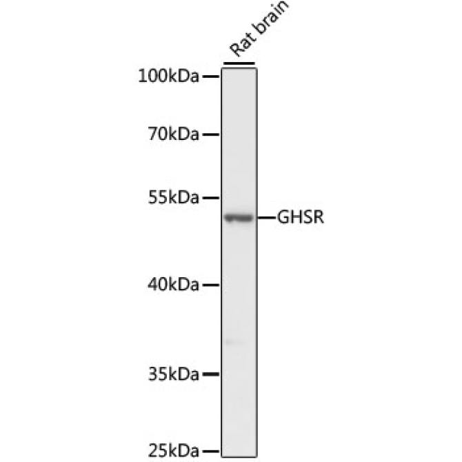 GHSR Rabbit Polyclonal Antibody