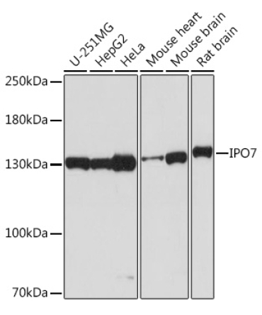 IPO7 Rabbit Polyclonal Antibody