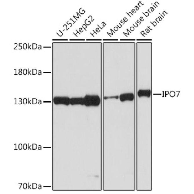 IPO7 Rabbit Polyclonal Antibody