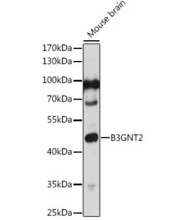 B3GNT2 Rabbit Polyclonal Antibody