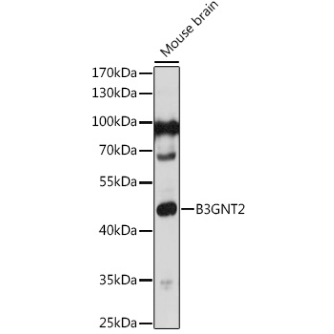 B3GNT2 Rabbit Polyclonal Antibody