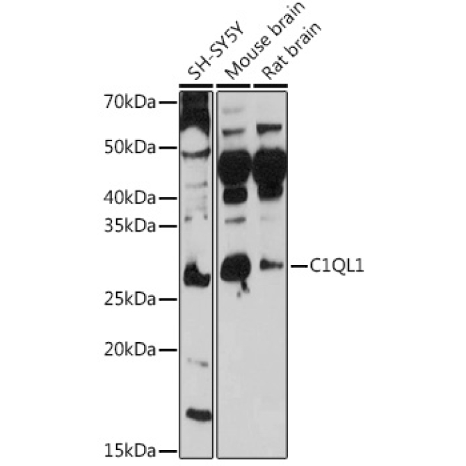 C1QL1 Rabbit Polyclonal Antibody