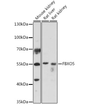 FBXO5 Rabbit Polyclonal Antibody