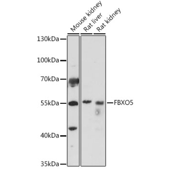 FBXO5 Rabbit Polyclonal Antibody